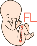 成長してない 胎児 fl 胎児のFLの成長について教えて下さい。